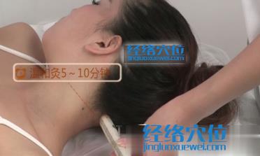 艾灸風池穴