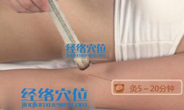 艾灸尺澤穴