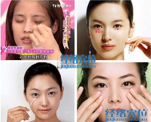 承泣穴的準確位置圖（高清圖組）