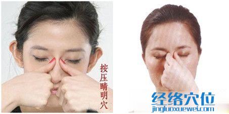 睛明穴