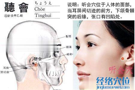 聽會穴位位置圖