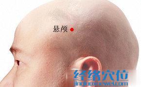 懸顱穴