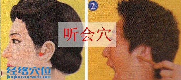 聽會穴的準確位置圖