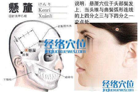 懸厘穴的位置解剖分析圖