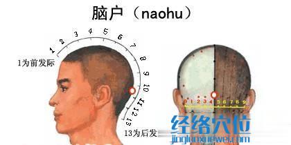 腦戶穴的準(zhǔn)確位置圖