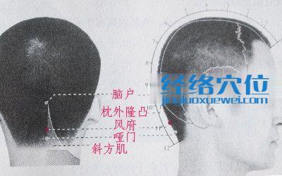 風(fēng)府穴的位置解剖分析圖
