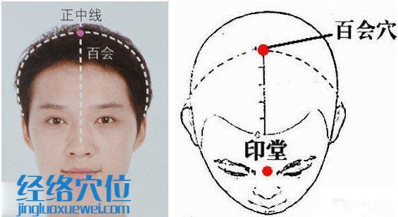 圖解百會穴的準確位置圖