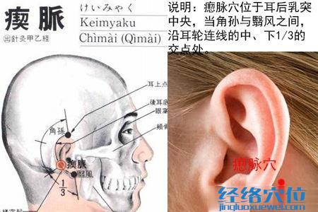 瘈脈穴的位置解剖分析圖