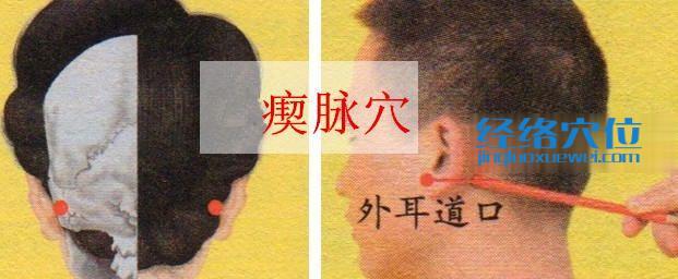 瘈脈穴的準確位置圖