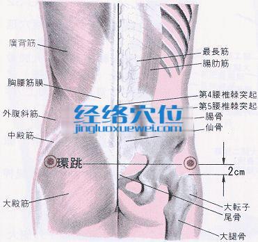 環跳穴的位置解剖分析圖