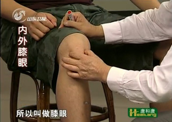 內膝眼、外膝眼治療膝關節疼痛、酸、以及骨刺的形成、膝關節積水