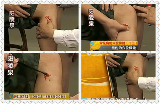 刺激陽陵泉治療扭挫傷